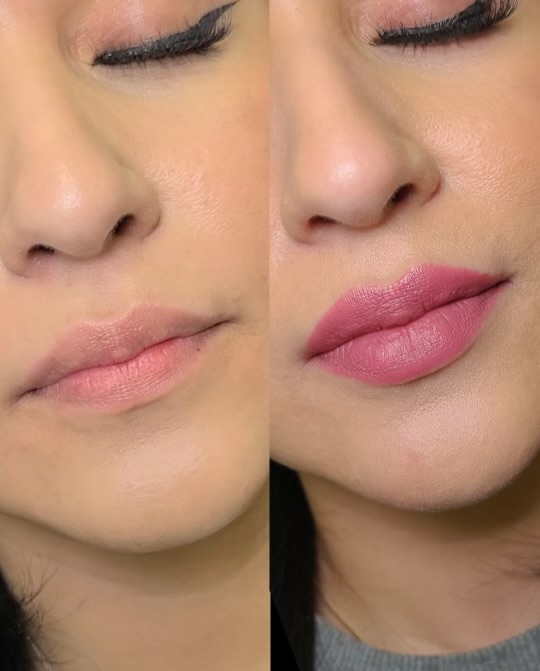 Before & After Results